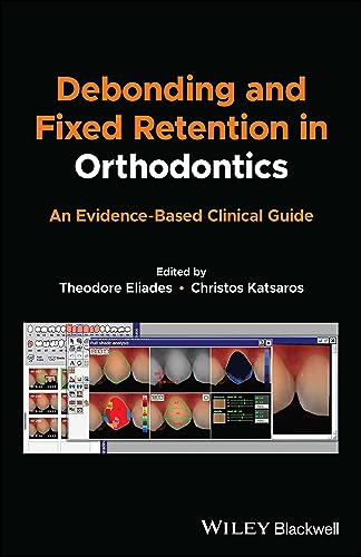 Debonding and Fixed Retention in Orthodontics: An Evidence-based Clinical Guide von Wiley-Blackwell